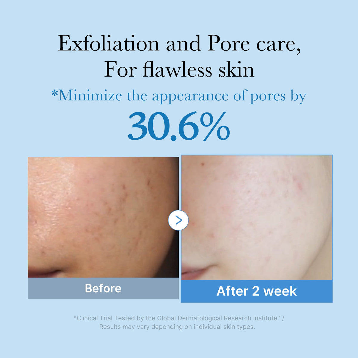 zero-pore-toner-y3 01_d6480b4e-3c08-4954-994a-ed5212c1839c.jpg