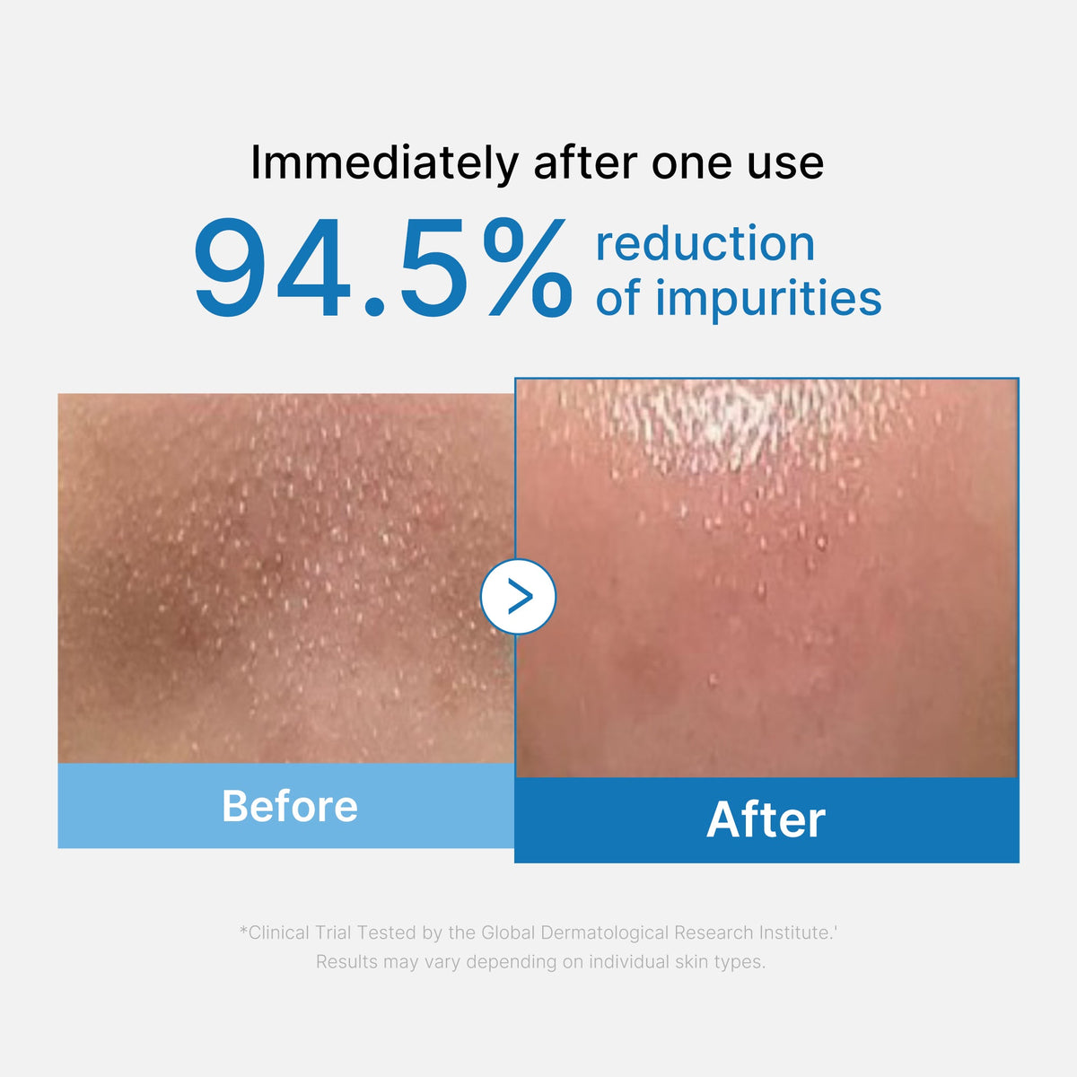 zero-pore-blackhead-deep-cleansing-oil-w7 01_eed557ec-5857-46a2-8b17-dbd67c692dcb.jpg