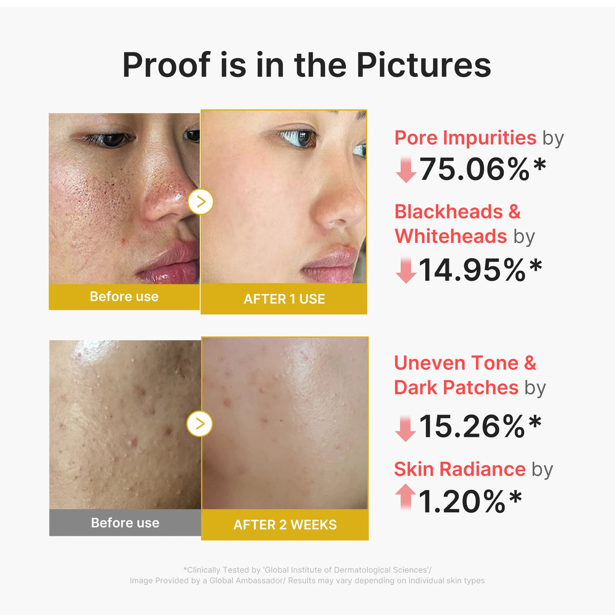 kojic-acid-turmeric-peel-shot-h7 02_45fe66d3-b3f6-4100-aa52-2afd7eded417.jpg