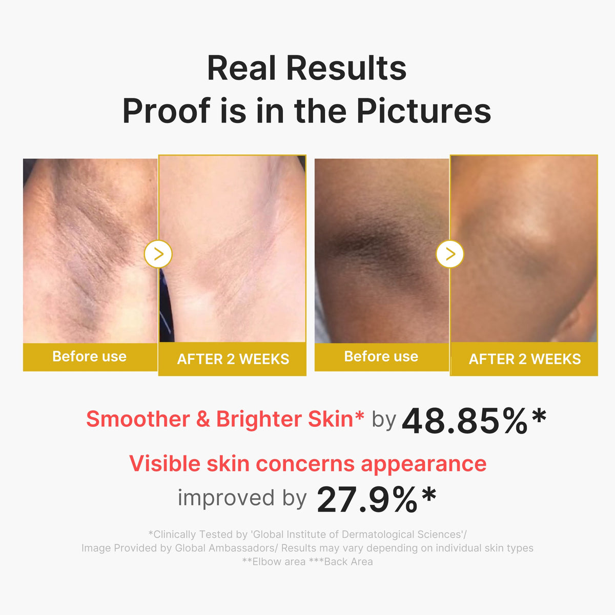 kojic-acid-turmeric-body-peel-shot-p8 02_72880cfc-382b-440b-8152-7e3dce87da2a.jpg