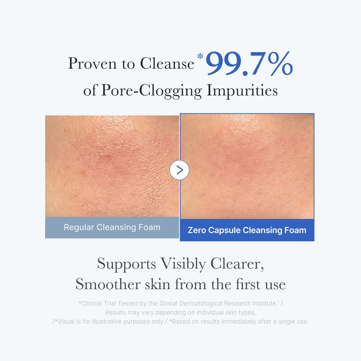 zero-pore-capsule-cleansing-foam-m7 02_c1fb9dfb-86c5-4038-8ff8-490d1006276c.jpg