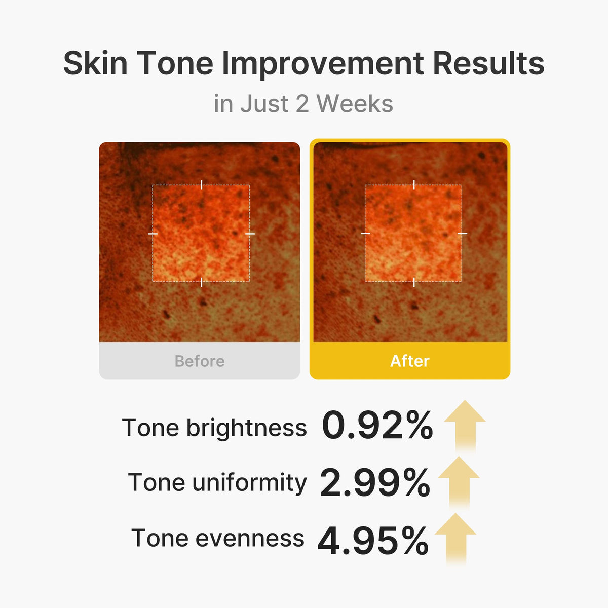 kojic-acid-turmeric-vita-capsule-cream-u4 03_2b626701-fc6c-4702-9e96-a2157a4f7f9d.jpg