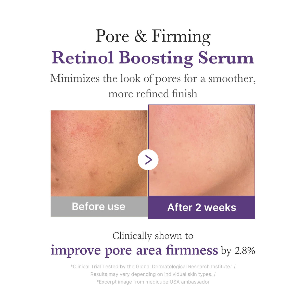 retinol-nmn-boosting-serum-v5 03_3510e7a5-5633-4a18-81ea-1389593bd517.jpg