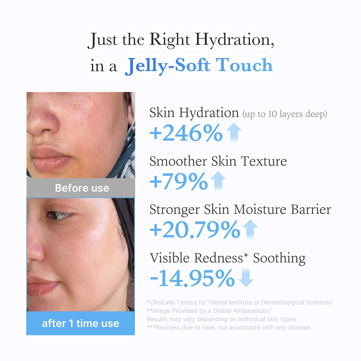 hyaluronic-ceramide-moisturizing-jelly-cream-w9 03_c39d66cc-0839-4e48-ab4a-d32143d06b1c.jpg