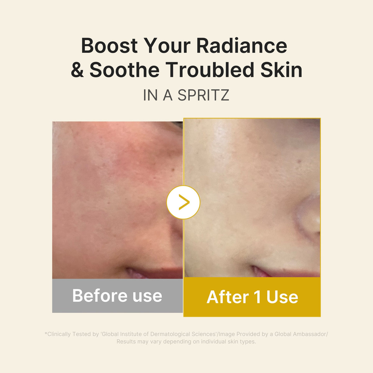 kojic-acid-turmeric-vitamin-gold-jelly-mist-serum-y5 03_dc9cd19e-4e57-49d3-9b66-c7762e8a63f1.jpg