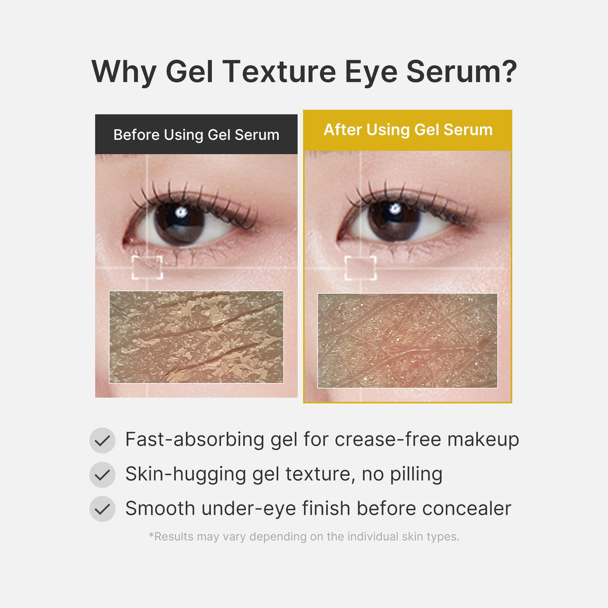 kojic-acid-tumeric-eye-gel-serum-d0 04_0487ef36-49f4-4294-8049-bb55118b05fe.jpg