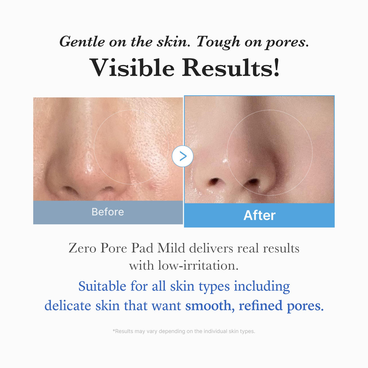 zero-pore-madecassoside-pads-mild-z5 04_6357f9f9-483b-4891-82c6-a58d336e62c8.jpg