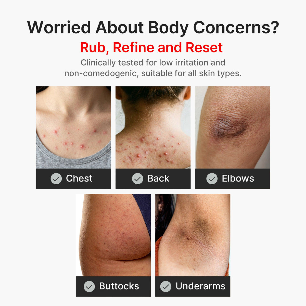 kojic-acid-turmeric-body-peel-shot-p8 04_8a7237f2-3ebf-401e-bd85-54841aeb3efc.jpg