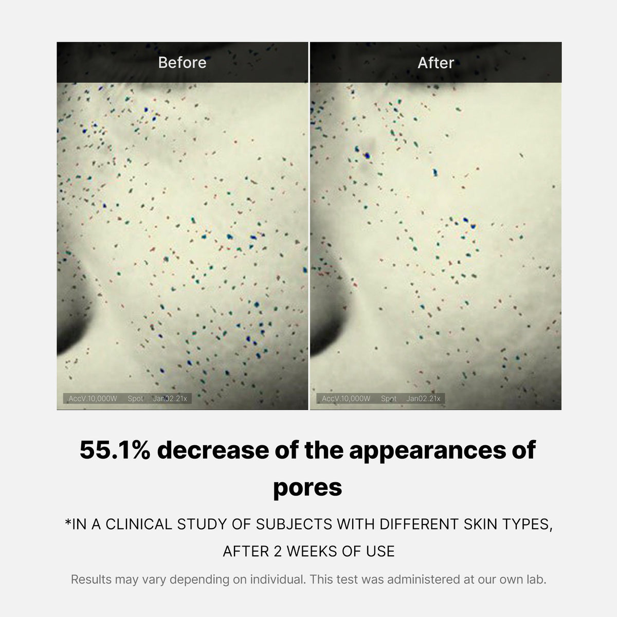 pore-care-duo-u9 05_12ddab8a-64be-4612-8ee1-27e5ec701921.jpg