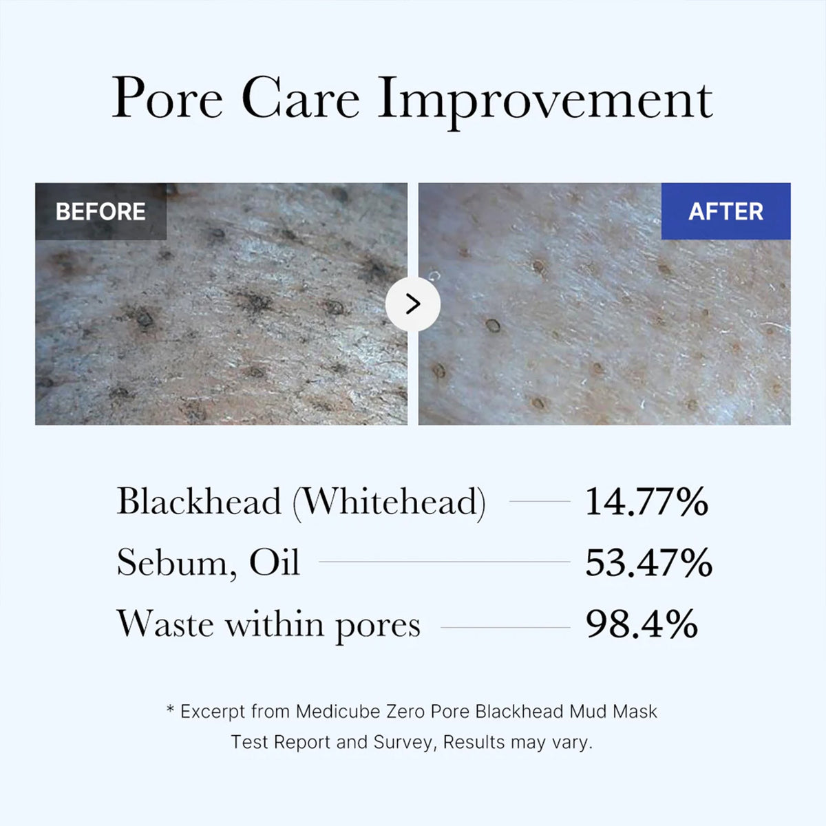 zero-pore-blackhead-mud-mask-s1 05_9362a158-c2b3-4525-acc0-631a2cfdea47.jpg