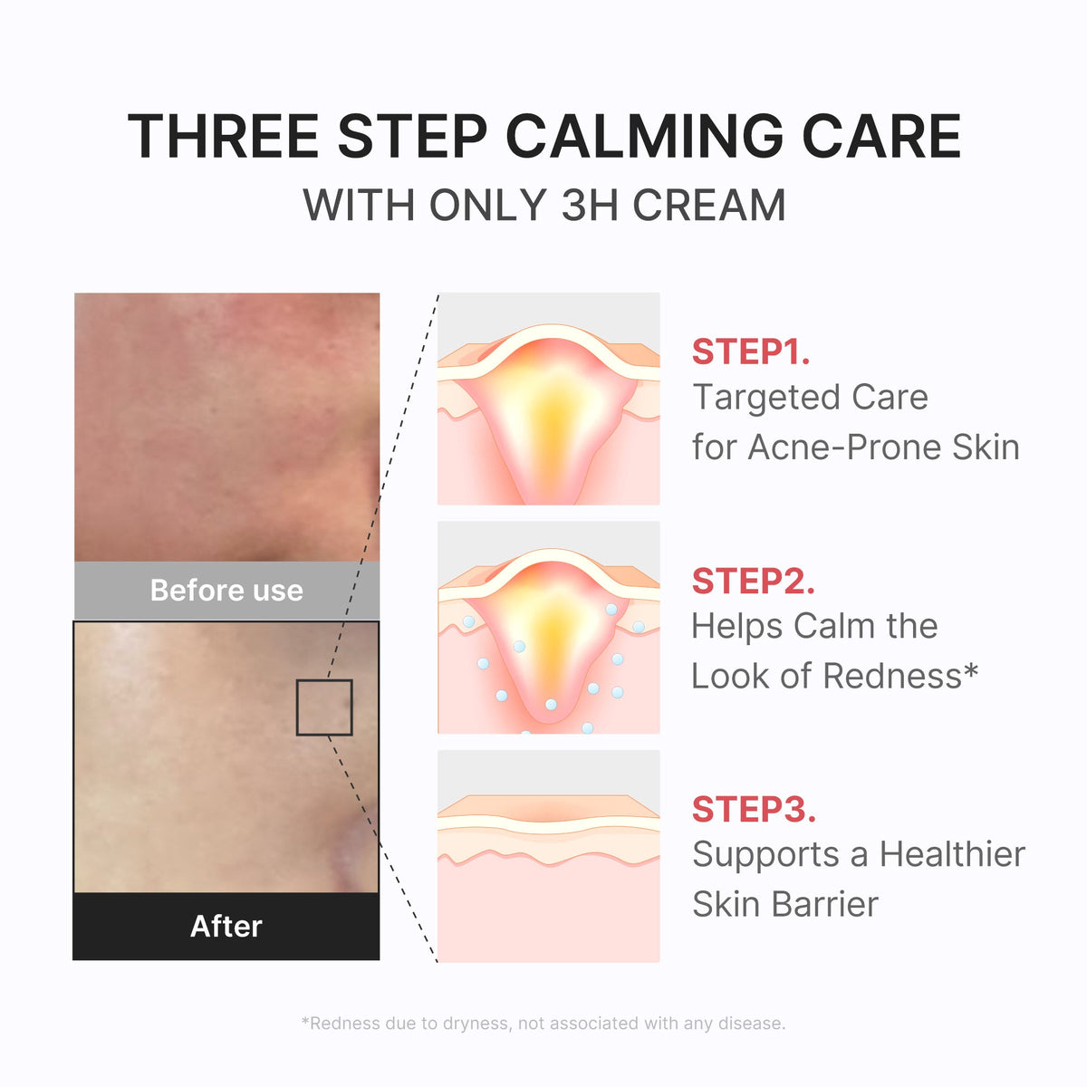 3h-daily-relief-cream-p3 3H_04.jpg