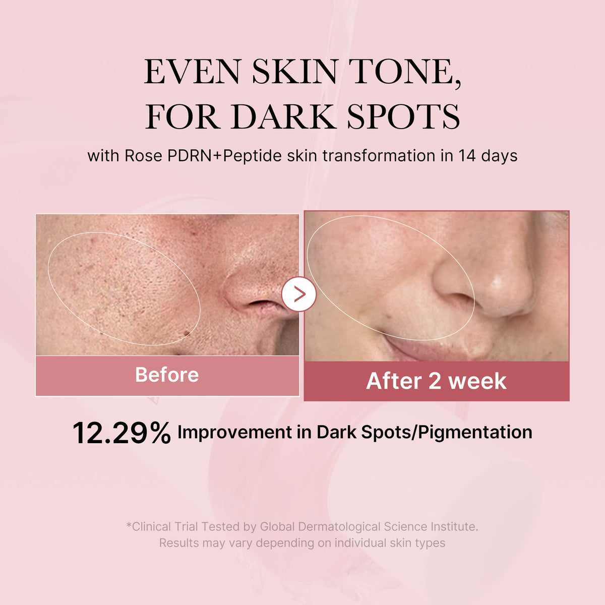 pdrn-pink-peptide-toner-i8 PDRN_01_308c518e-5ac6-4e54-99bd-eabc8796739b.jpg