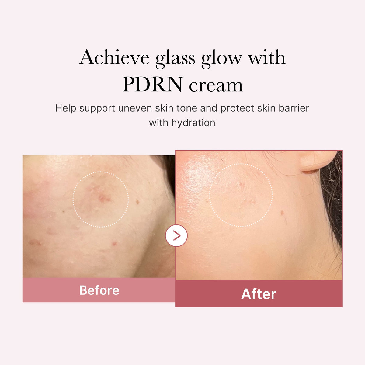 pdrn-pink-peptide-cream-r5 PDRN_02_d7805bfe-cf43-446a-b71b-a276683f136b.jpg
