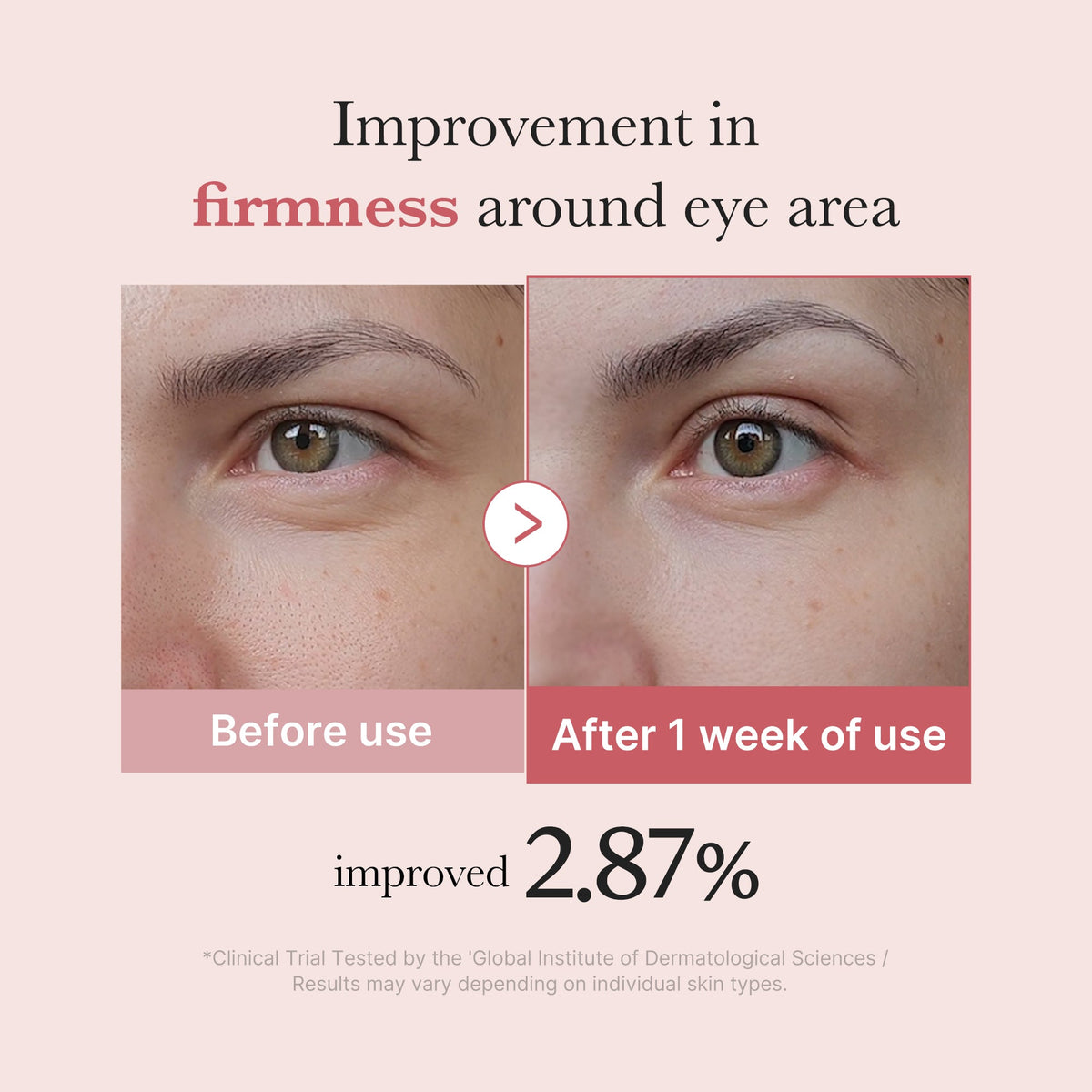 pdrn-pink-peptide-eye-cream-n3 PDRN_03_256dd753-0a2f-41b4-b3cd-bbfd3bc27018.jpg