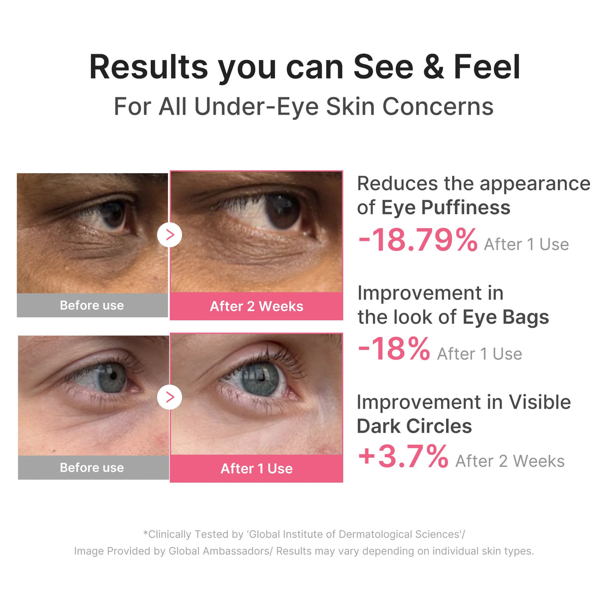 pdrn-caffeine-collagen-eye-patch-n5 PDRN_03_cdce2143-b8d8-43cb-ac69-fcbdf6640249.jpg