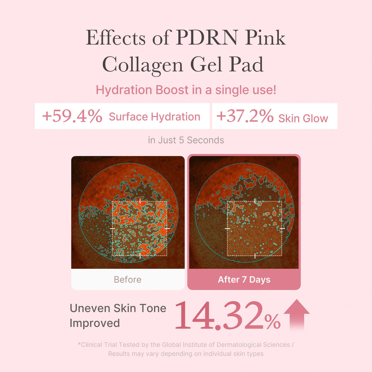 pdrn-pink-collagen-gel-toner-pad-v6 PDRN_04_f9a16a56-8d9e-4c47-a635-ed34ec3ed571.jpg