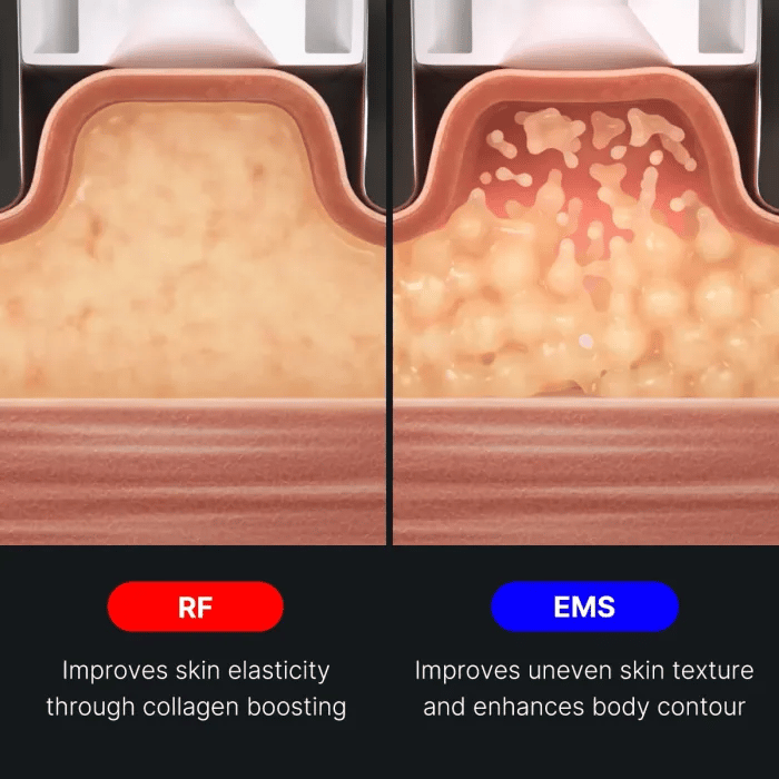 age-r-contour-body-shot-m1 img.webp